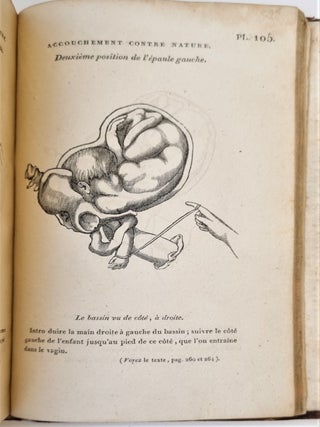 Item #3720 Mémorial de l’art des accouchemens. BOIVIN, Mme Veuve