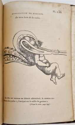 Mémorial de l’art des accouchemens