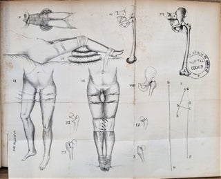 Item #3758 Mémoire sur les moyens de remédier aux imperfections de quelques procédés pour les...