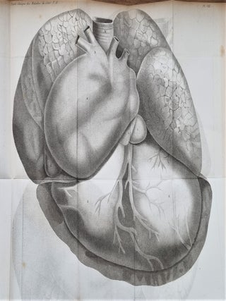 Item #3762 Traité clinique des maladies du coeur, précédé de recherches nouvelles sur...