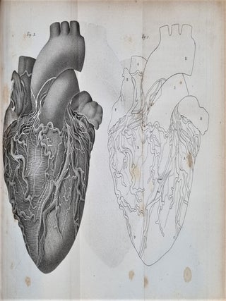 Traité clinique des maladies du coeur, précédé de recherches nouvelles sur l'anatomie et la physiologie de cet organe
