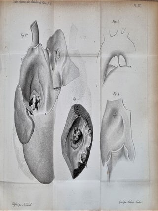 Traité clinique des maladies du coeur, précédé de recherches nouvelles sur l'anatomie et la physiologie de cet organe