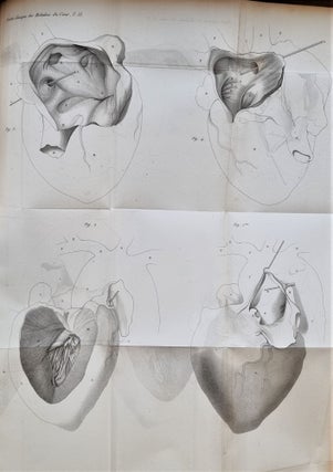 Traité clinique des maladies du coeur, précédé de recherches nouvelles sur l'anatomie et la physiologie de cet organe