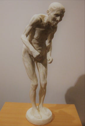 La parkinsonienne - Statuette d'une femme ayant la maladie de Parkinson. Paul Richer.