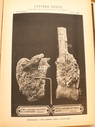 Catalogue des pièces du Musée Dupuytren