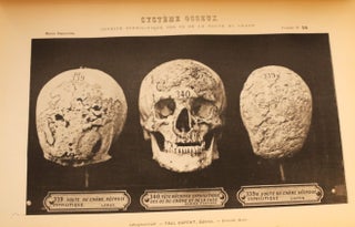 Catalogue des pièces du Musée Dupuytren