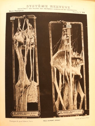 Catalogue des pièces du Musée Dupuytren