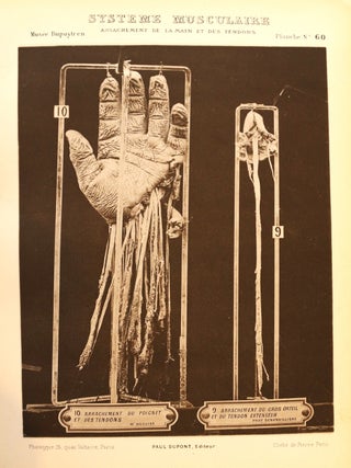 Catalogue des pièces du Musée Dupuytren