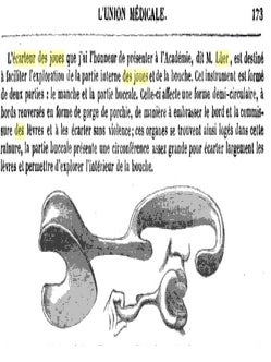 Ecarteur des joues en bois, vers 1861