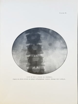 Les Rayons X et leurs applications. Radioscopie – radiographie – radiothérapie – radioactivité