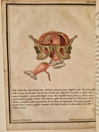 Abbrégé de l'art des accouchemens, dans lequel on donne les préceptes nécessaires pour le mettre heureusement en pratique, & auquel on a joint plusieurs observations intéressantes sur des cas singuliers