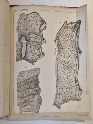 Item #5084 Mémoire sur la psorentérie, ou choléra de Paris. SERRES et NONAT,...