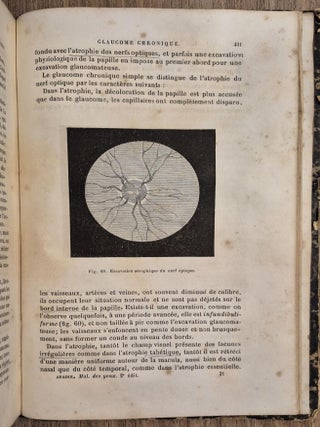 Traité des maladies des yeux