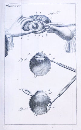 Traité de la cataracte et du glaucoma