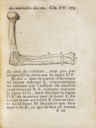 Item #YEG-873 L'art de guerir les maladies des os. PETIT, Jean Louis